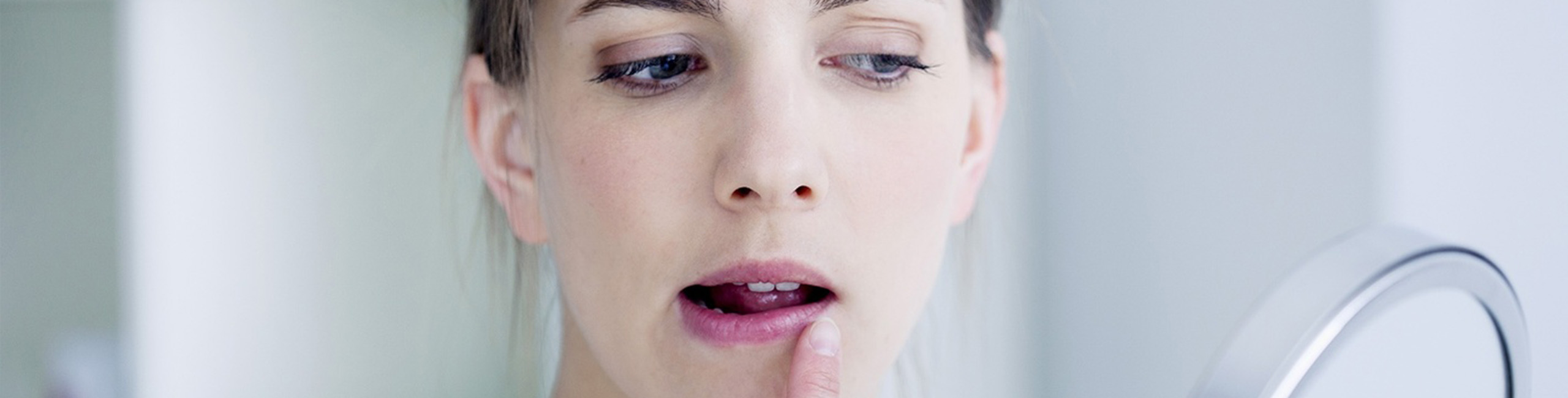 Ar dažnai sergate pūsleline? Sužinokite, kaip kitą kartą jos išvengti